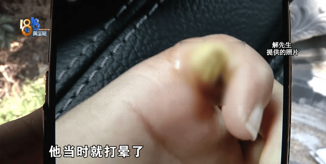 5岁男童瞬间晕厥<strong></p>
<p>币特币交易平台</strong>，筋都断了！街上常见，看见立即远离