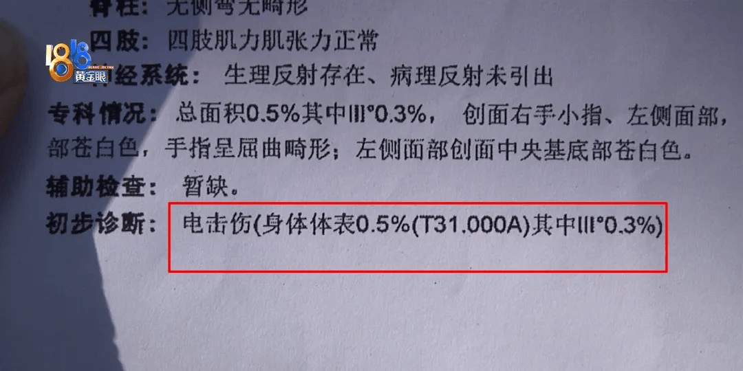 5岁男童瞬间晕厥<strong></p>
<p>币特币交易平台</strong>，筋都断了！街上常见，看见立即远离