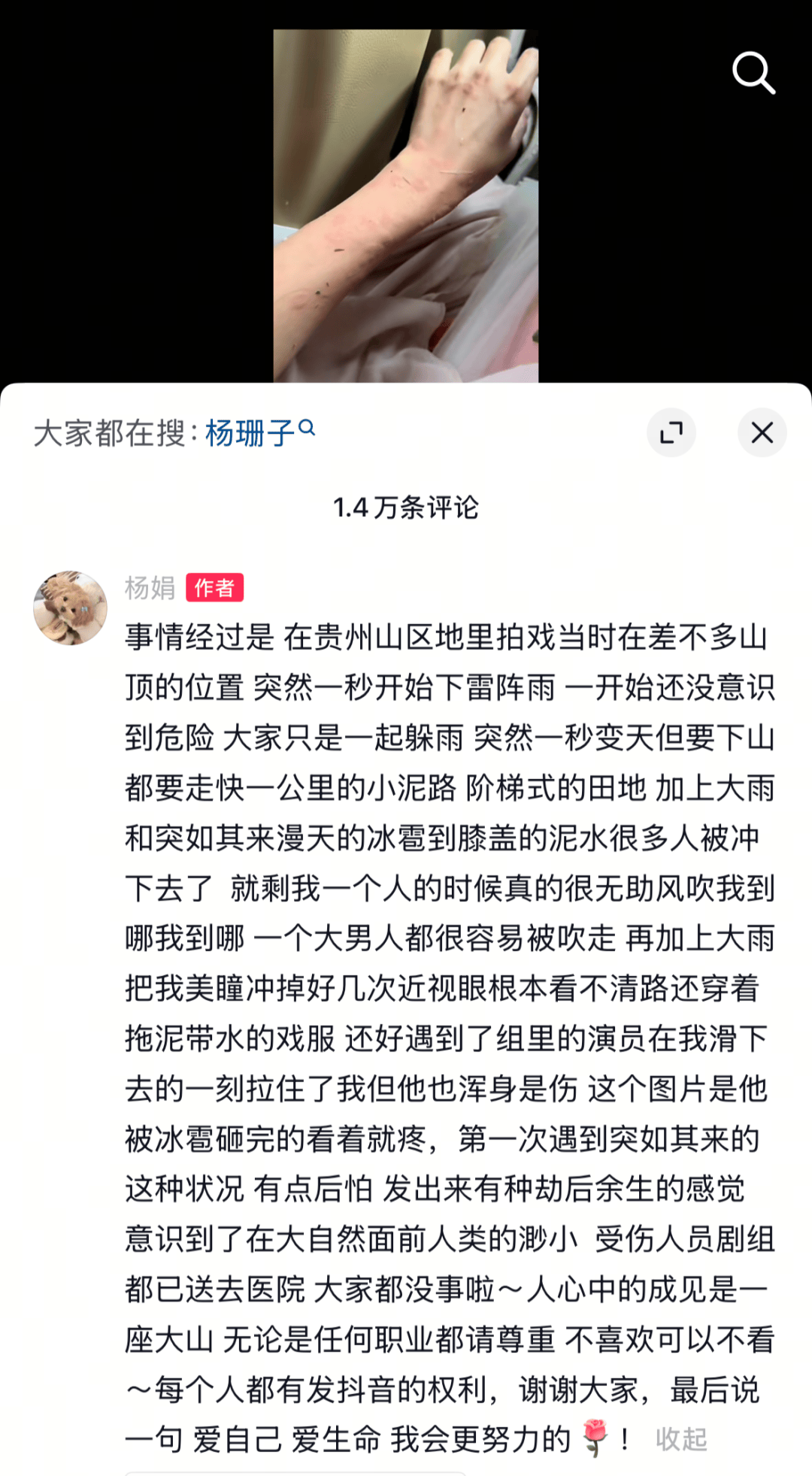 女演员杨珊子拍戏遇极端天气！胳膊被冰雹砸伤、美瞳被冲掉<strong></p>
<p>炒币交易平台</strong>，剧组受伤人员已送医