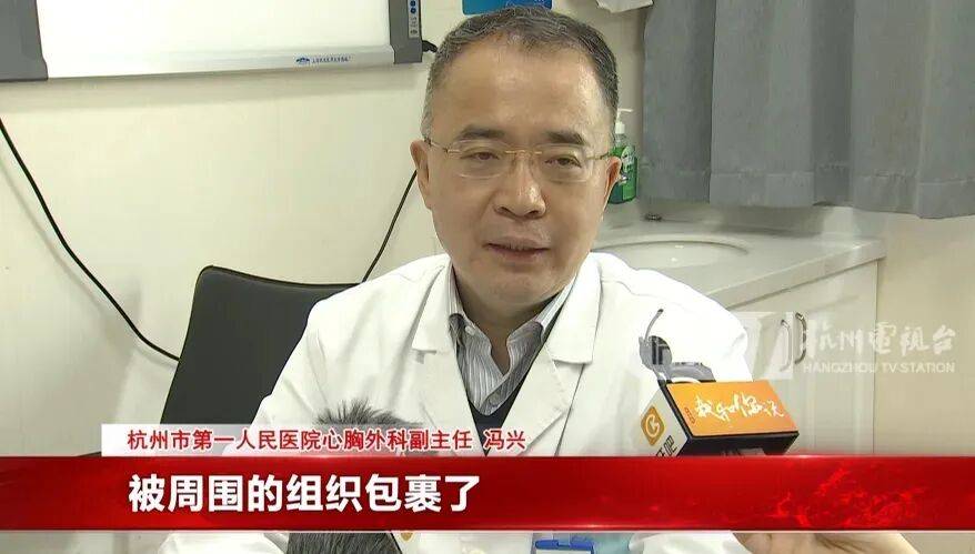 17岁小伙参军体检发现胸腔内有根5cm缝衣针<strong></p>
<p>奥德赛虚拟币</strong>,父母回忆或是1岁时扎入,取出时已锈迹斑斑